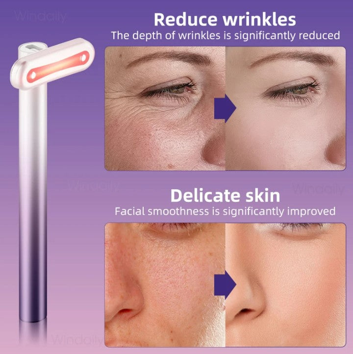 4-in-1 Facial Wand: EMS Microcurrent, Red Light & Warm Vibration Lifting Device (Purple)